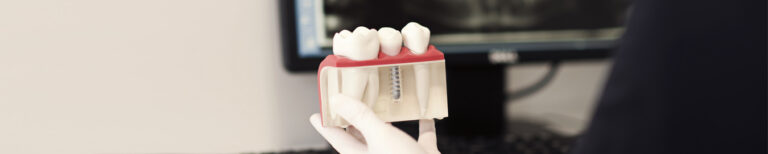 Implantacija